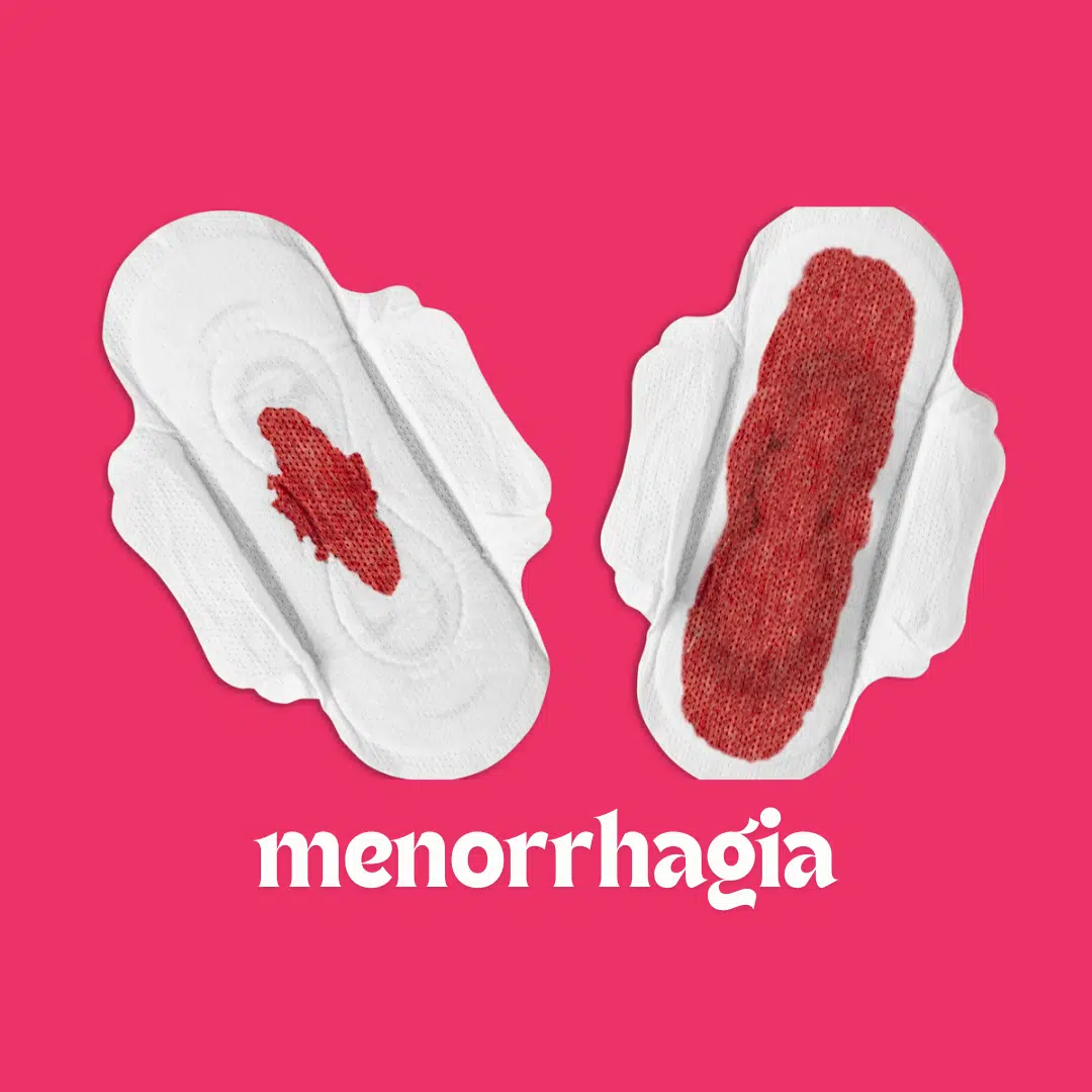 Heavy Periods