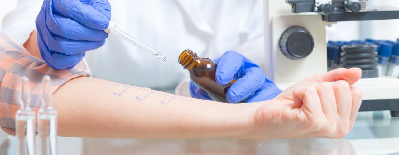 private allergy test on a patient.